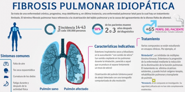La fibrosis pulmonar idiopática, padecimiento raro, afecta a millones de mexicanos.